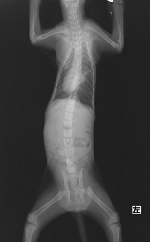 横隔膜ヘルニアの手術直後のレントゲン写真